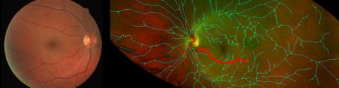 ECRF Imaging Retinal 1 Retinal Imaging 1