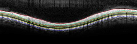 ECRF Imaging Retinal 2 Retinal Imaging 2