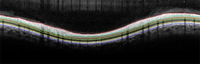 Retinal Imaging 2